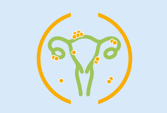 Grafische Darstellung Gebärmutter und Eierstöcke symbolisieren das Endometriosezentrum im Albertinen Krankenhaus