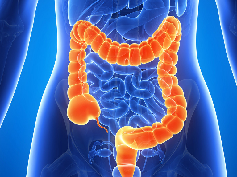 Grafik Dickdarm, Allgemein-, Viszeral- und Tumorchirurgie, Albertinen Krankenhaus, Hamburg-Schnelsen Grafik Dickdarm, Allgemein-, Viszeral- und Tumorchirurgie, Albertinen Krankenhaus, Hamburg-Schnelsen