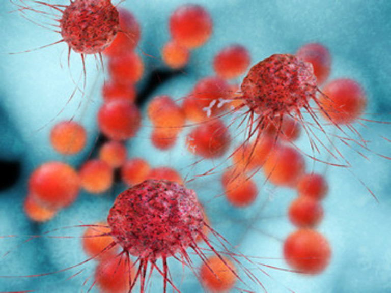 Grafik Metastasen und bösartiger Tumor, Allgemein-, Viszeral- und Tumorchirurgie, Albertinen Krankenhaus, Hamburg-Schnelsen Grafik Metastasen und bösartiger Tumor, Allgemein-, Viszeral- und Tumorchirurgie, Albertinen Krankenhaus, Hamburg-Schnelsen